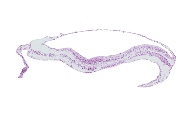 endoderm, neural groove, notochordal process, transverse groove