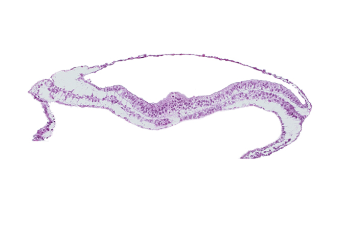 amnion, amniotic cavity, lateral plate mesoderm, notochordal process, umbilical vesicle cavity, umbilical vesicle wall