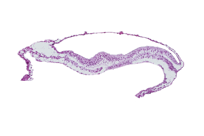 amnion, amniotic cavity, neural groove, notochordal process, transverse groove, umbilical vesicle cavity