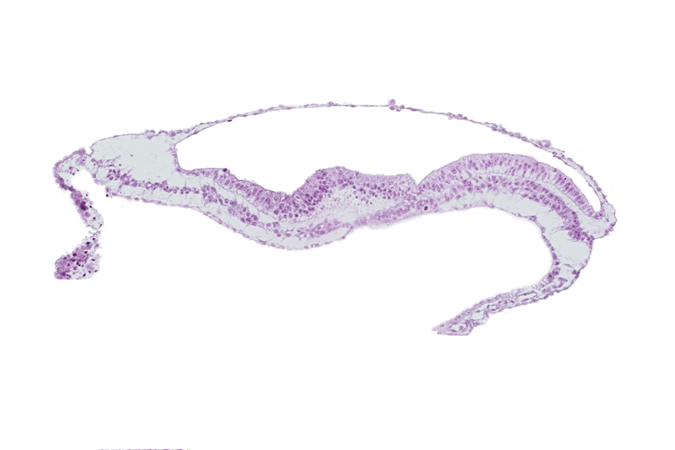 amnion, amniotic cavity, epiblast, notochordal (primitive) pit, notochordal process, umbilical vesicle cavity, umbilical vesicle wall