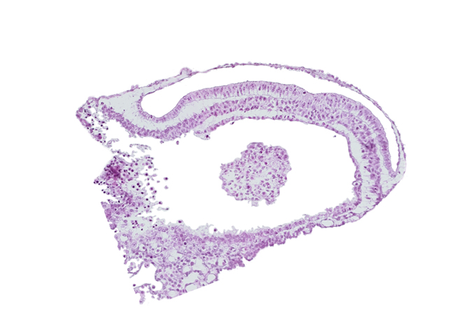 amniotic cavity, connecting stalk mesenchyme, extra-embryonic coelom, junction of embryonic and extra-embryonic mesoderm, umbilical vesicle cavity, umbilical vesicle wall cut tangentially