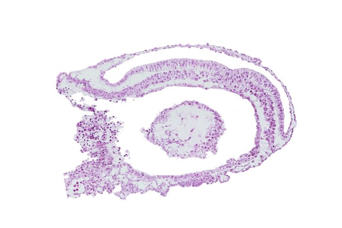 blood vessel(s), connecting stalk, embryonic endoderm, endometrial epithelium, extra-embryonic coelom, extra-embryonic endoderm, gastrulation (primitive) groove, gastrulation (primitive) streak, umbilical vesicle wall