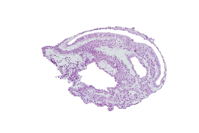 allantoic diverticulum, amnion, blood vessel(s), connecting stalk, endoderm, epiblast, extra-embryonic coelom, extra-embryonic endoderm, gastrulation (primitive) groove, mesoderm, umbilical vesicle cavity