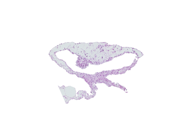 cephalic edge of cardiac mesoderm, continuity of umbilical vesicle wall, umbilical vesicle cavity