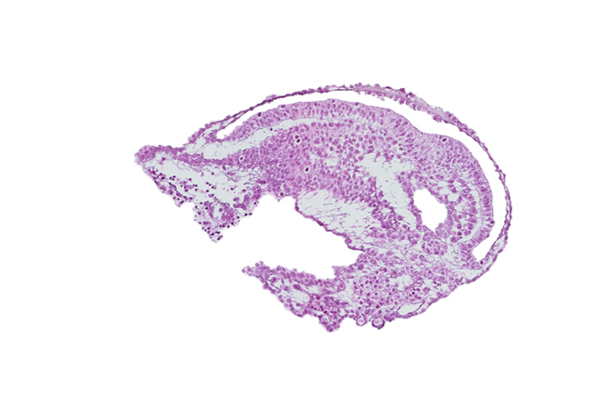 allantoic diverticulum, amniotic cavity, endoderm, extra-embryonic coelom, extra-embryonic endoderm, gastrulation (primitive) groove, mesoderm, umbilical vesicle cavity