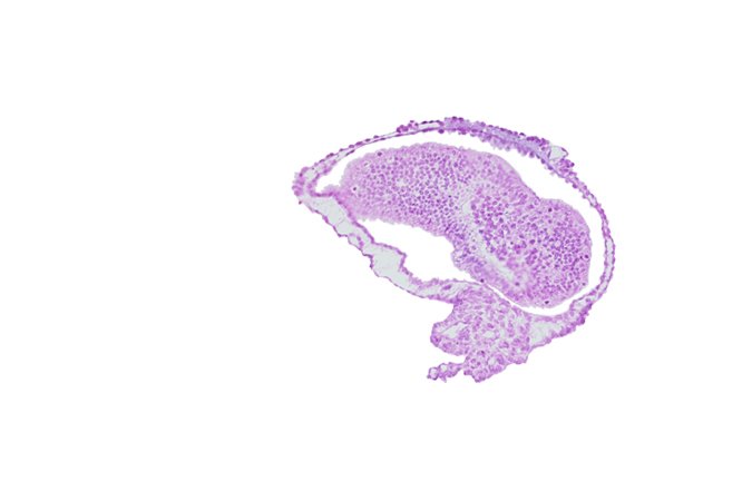 allantoic diverticulum in connecting stalk, amniotic cavity, caudal eminence, gastrulation (primitive) groove, mesoderm, tangentially cut epiblast