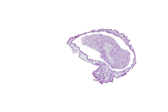 allantoic diverticulum in connecting stalk, amniotic cavity, caudal eminence, gastrulation (primitive) groove