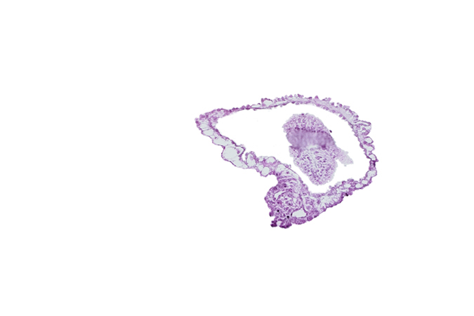 allantoic diverticulum in connecting stalk, amniotic cavity, caudal eminence, extra-embryonic coelom