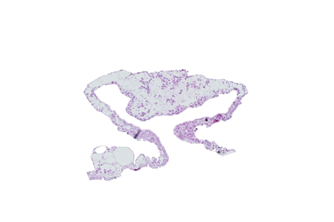 cardiac mesoderm, umbilical vesicle cavity