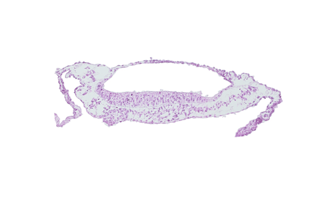 amnion, neuroepithelium, prechordal plate