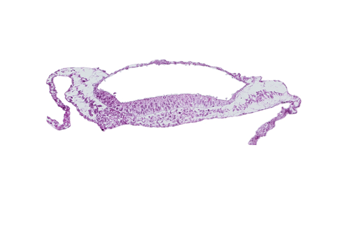 amnion, amniotic cavity, prechordal plate, umbilical vesicle cavity, umbilical vesicle wall