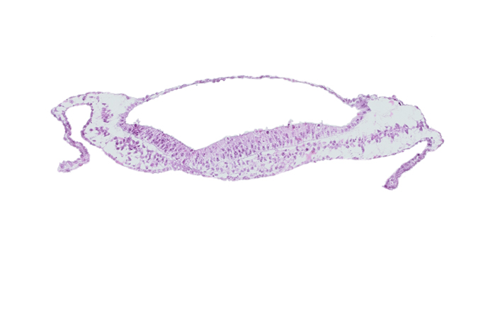 neural groove, notochordal plate