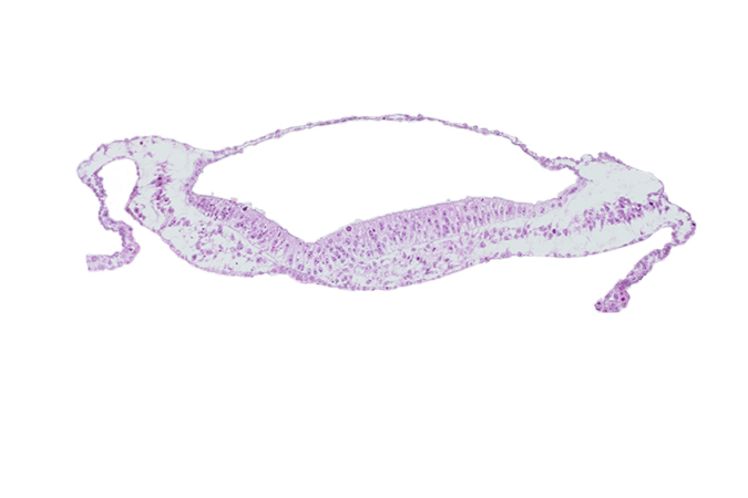 amnion, amniotic cavity, notochordal plate