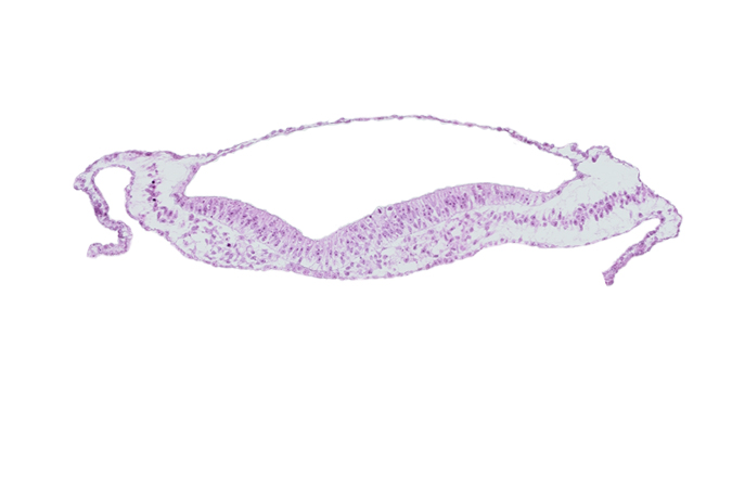 embryonic endoderm, extra-embryonic mesoderm, neural groove