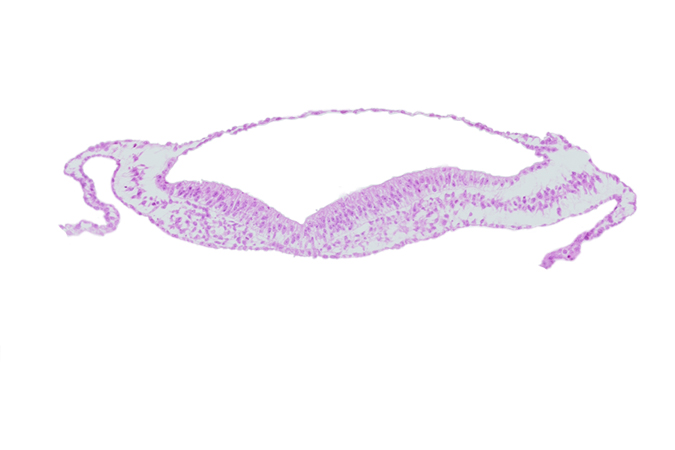 amniotic cavity, head mesenchyme, isolated coelomic space, notochordal plate, umbilical vesicle cavity, umbilical vesicle hemangiogenesis