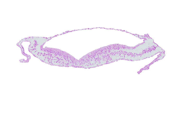 head mesenchyme, neural fold, neural groove, notochordal plate