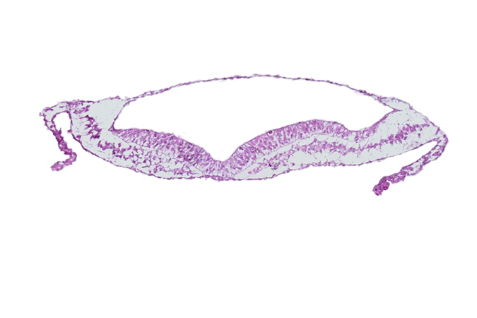 amniotic cavity, head mesenchyme, notochordal plate, umbilical vesicle wall