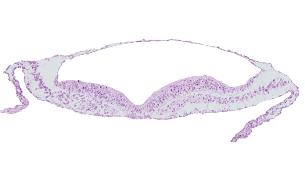 embryonic endoderm, head mesenchyme, neural fold, neural groove, notochordal plate