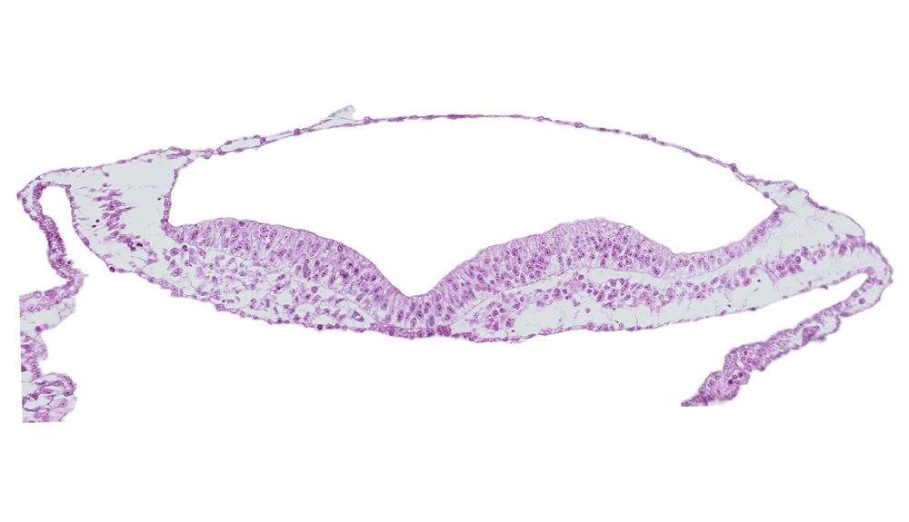 amnion, amniotic cavity, umbilical vesicle cavity, umbilical vesicle wall