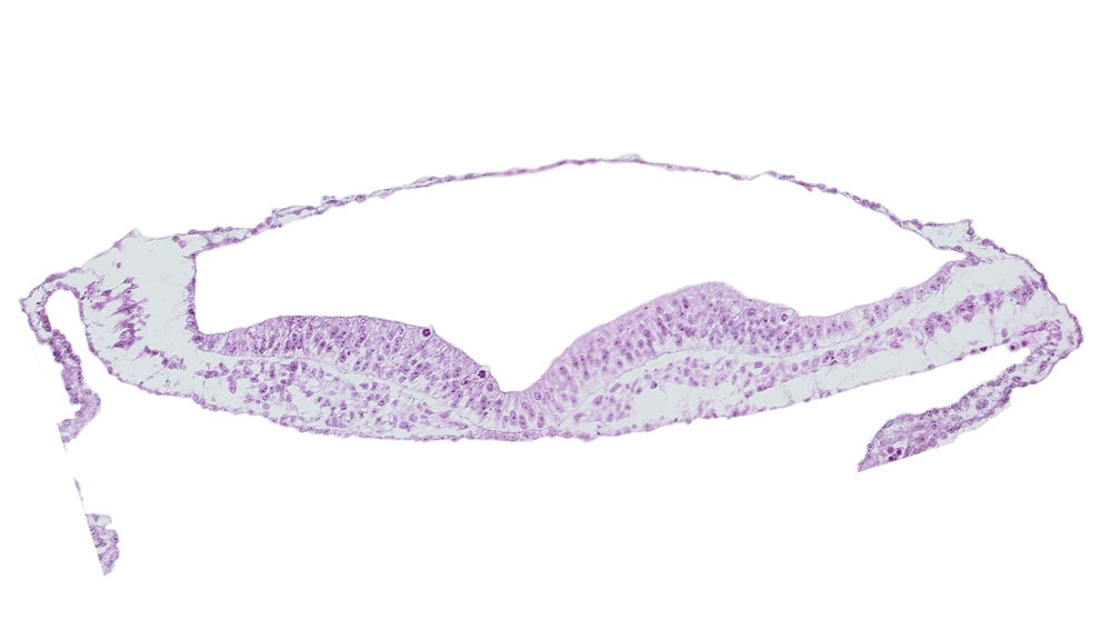 embryonic endoderm, neural fold, neural groove, notochordal plate, presumptive neural crest