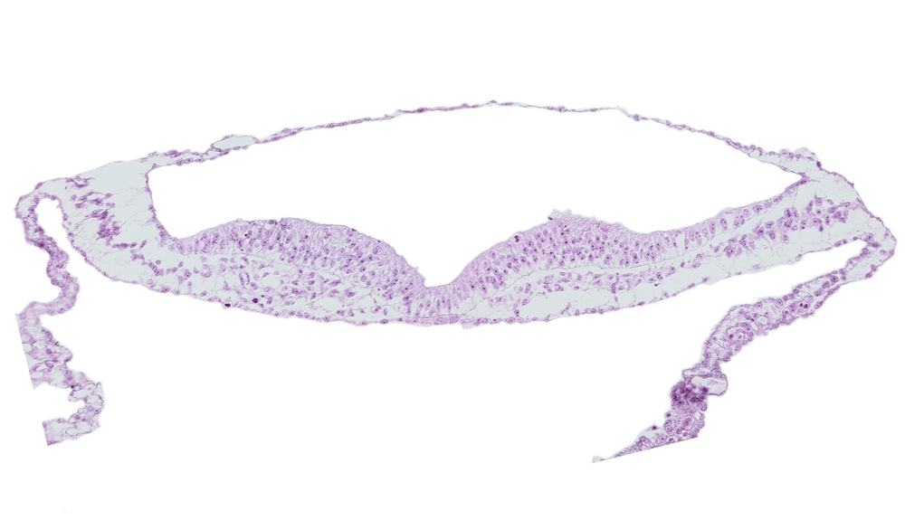 embryonic endoderm, neural fold, neural groove, notochordal plate, presumptive neural crest