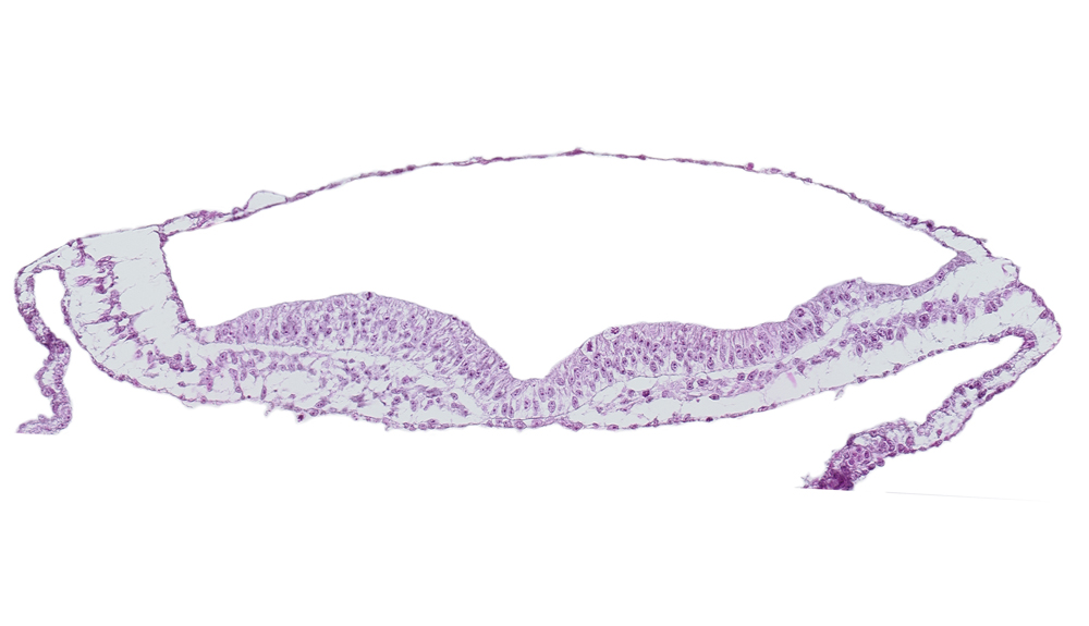 endoderm, extra-embryonic mesoderm, neural fold, neural groove, notochordal plate, transverse groove
