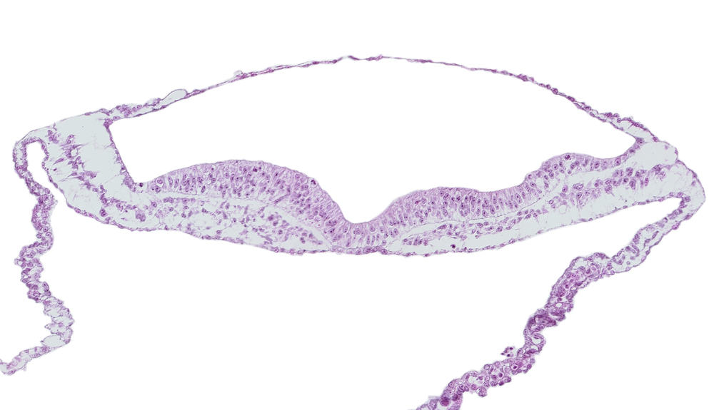 endoderm, neural groove, notochordal plate, transverse groove