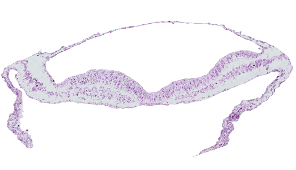 amnion, extra-embryonic endoderm, extra-embryonic mesoderm, head mesenchyme, neural groove, notochordal plate