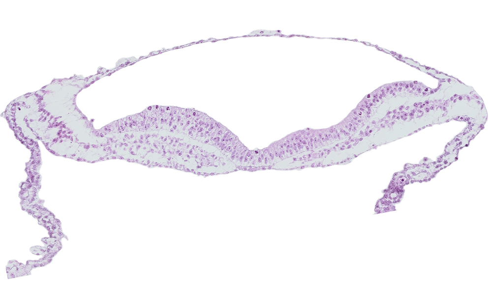 amniotic cavity, endoderm, transverse groove, umbilical vesicle wall