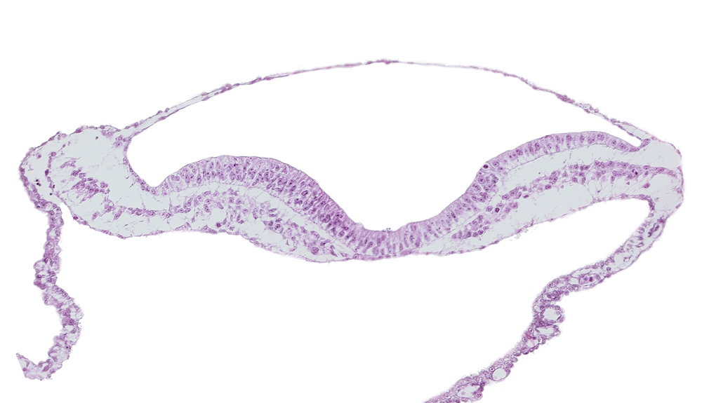 lateral plate mesoderm, neural groove, notochordal plate, paraxial mesoderm, umbilical vesicle hemangiogenesis