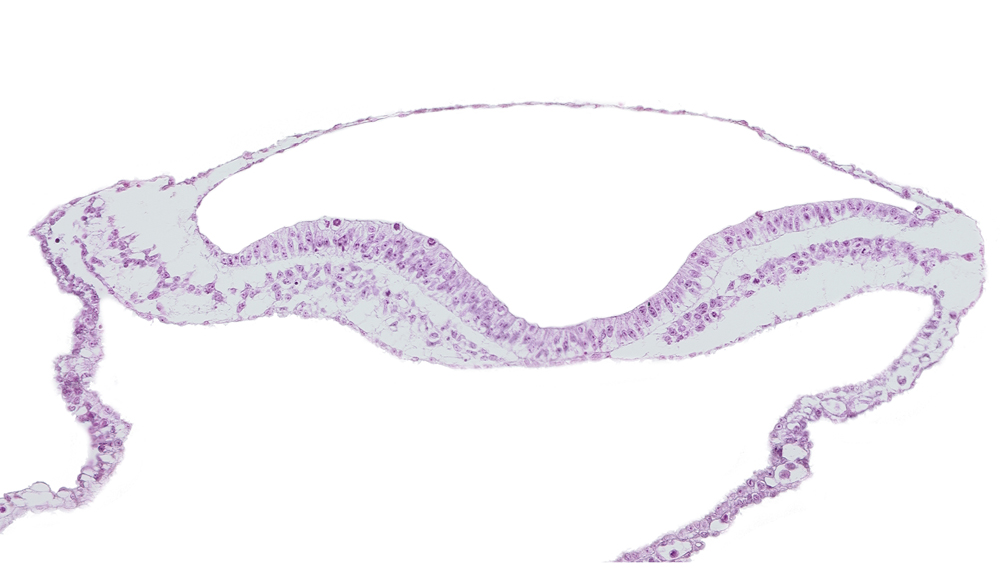 amnion, amniotic cavity, isolated coelomic space, notochordal plate