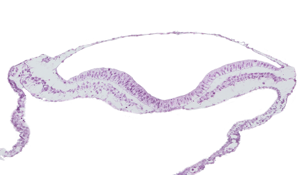 amnion, extra-embryonic endoderm, extra-embryonic mesoderm, head mesenchyme, neural fold, neural groove, notochordal plate, umbilical vesicle cavity