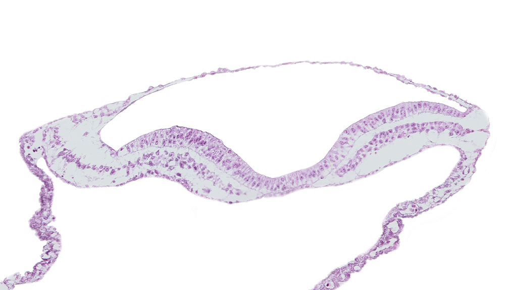 endoderm, neural fold, neural groove, notochordal plate