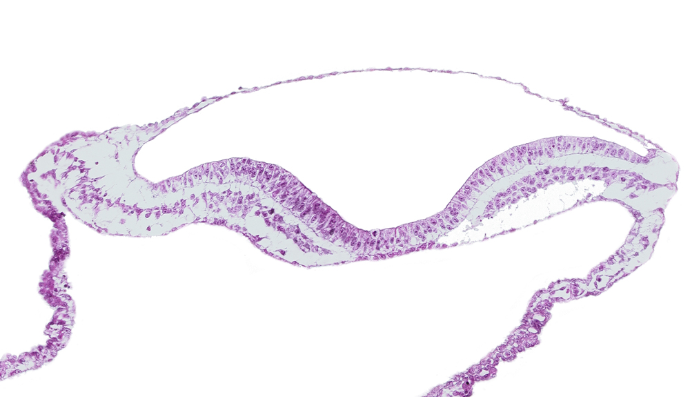 amnion, blood vessel(s), extra-embryonic endoderm, extra-embryonic mesoderm, head mesenchyme, neural fold, neural groove, notochordal plate, ventral groove (artifact?)