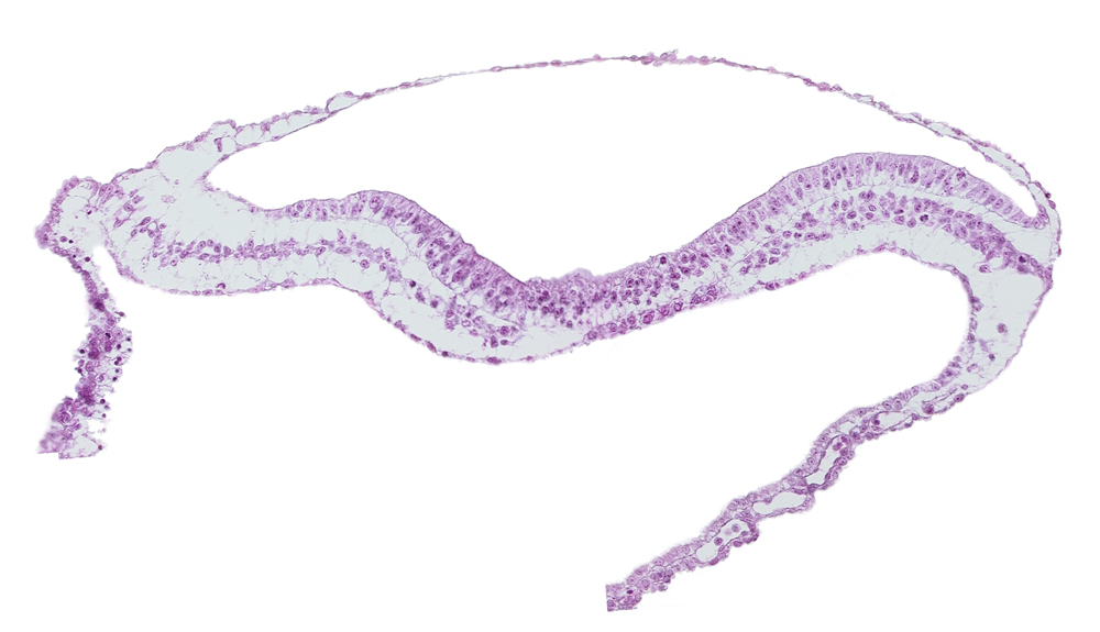 extra-embryonic endoderm, extra-embryonic mesoderm, isolated coelomic space, umbilical vesicle cavity