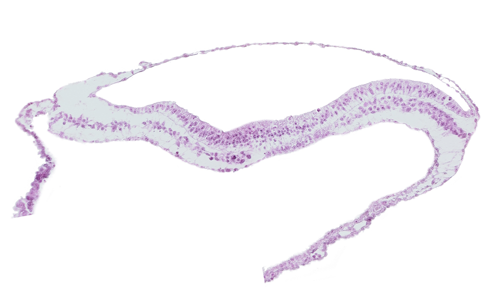 endoderm, neural groove, notochordal process, transverse groove