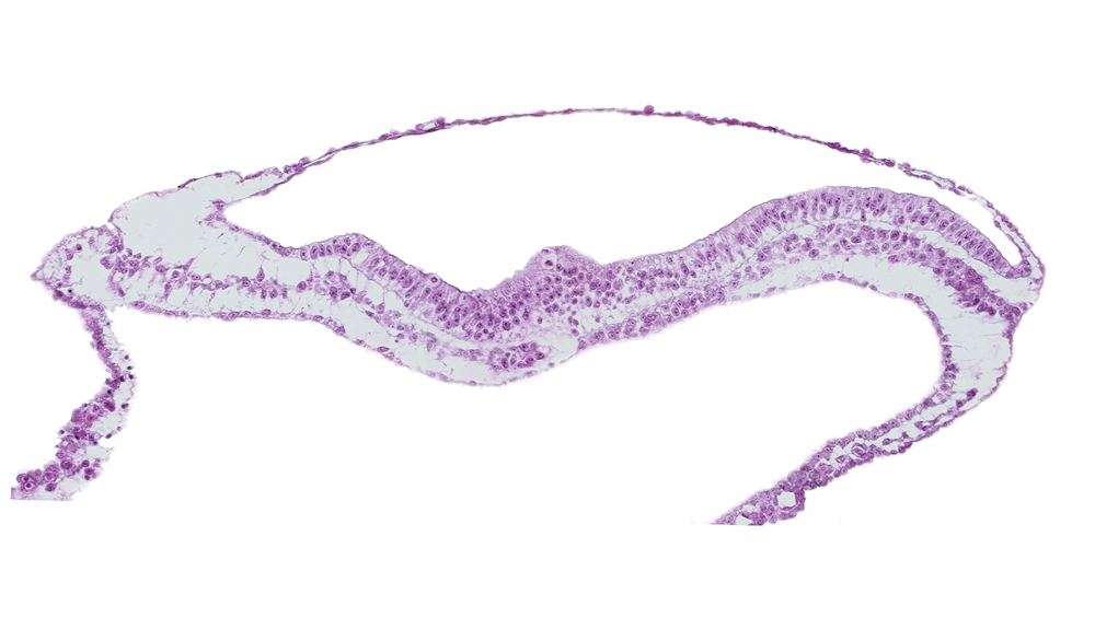 amnion, amniotic cavity, lateral plate mesoderm, notochordal process, umbilical vesicle cavity, umbilical vesicle wall