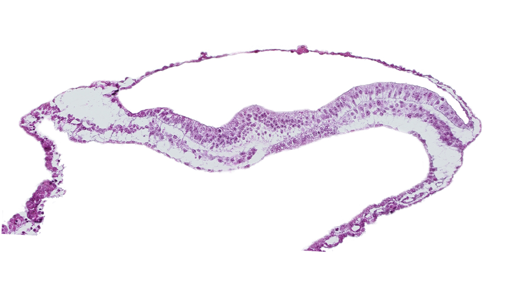 amnion, amniotic cavity, neural groove, notochordal process, transverse groove, umbilical vesicle cavity