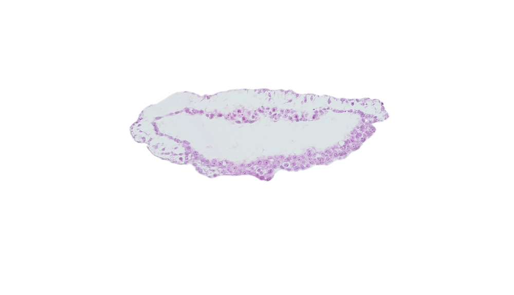 umbilical vesicle wall