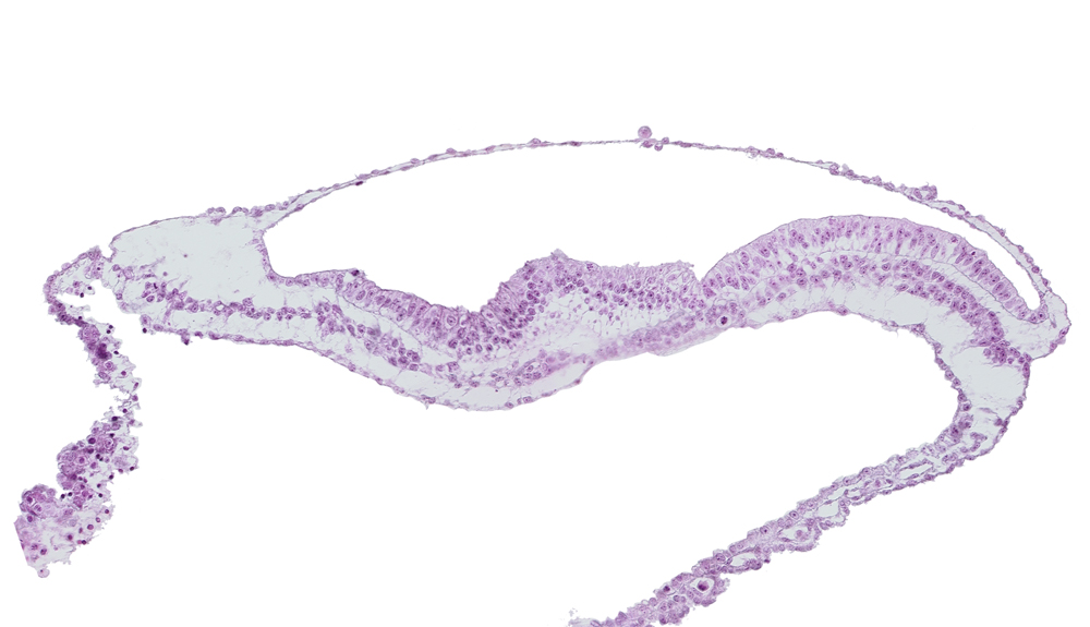 amnion, amniotic cavity, epiblast, notochordal (primitive) pit, notochordal process, umbilical vesicle cavity, umbilical vesicle wall