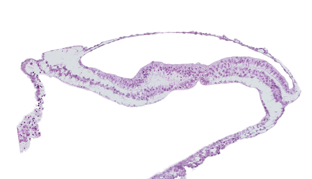 amniotic cavity, endoderm, epiblast, mesoderm, neurenteric canal, transverse groove, umbilical vesicle cavity