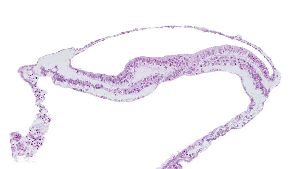 amnion, notochordal process, transverse groove, umbilical vesicle wall