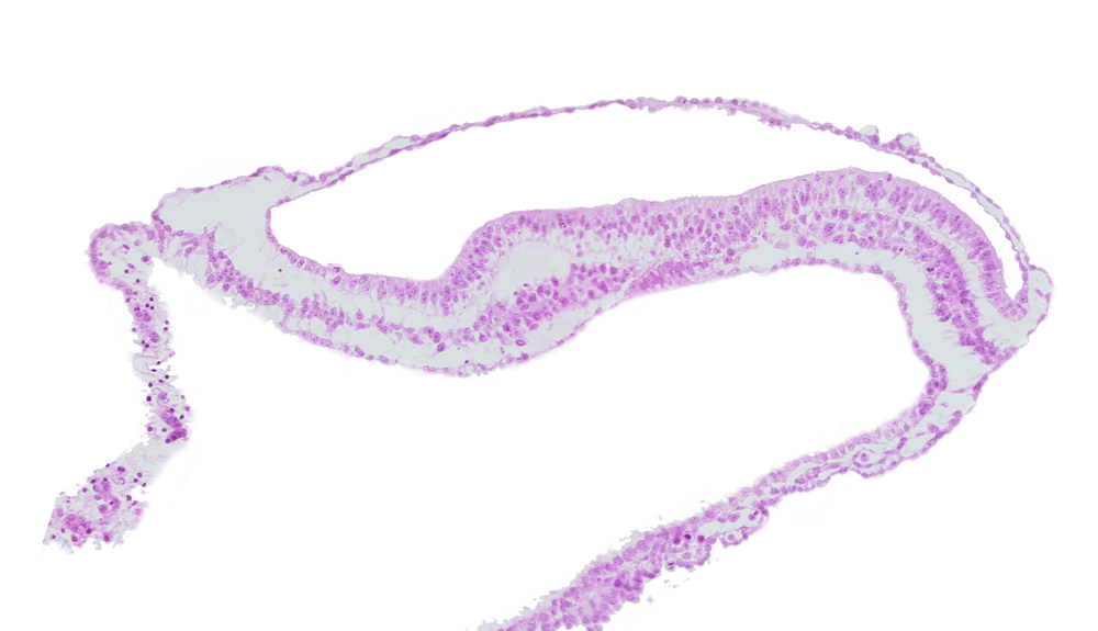 gastrulation (primitive) groove, gastrulation (primitive) streak, lateral plate mesoderm, paraxial mesoderm, transverse groove