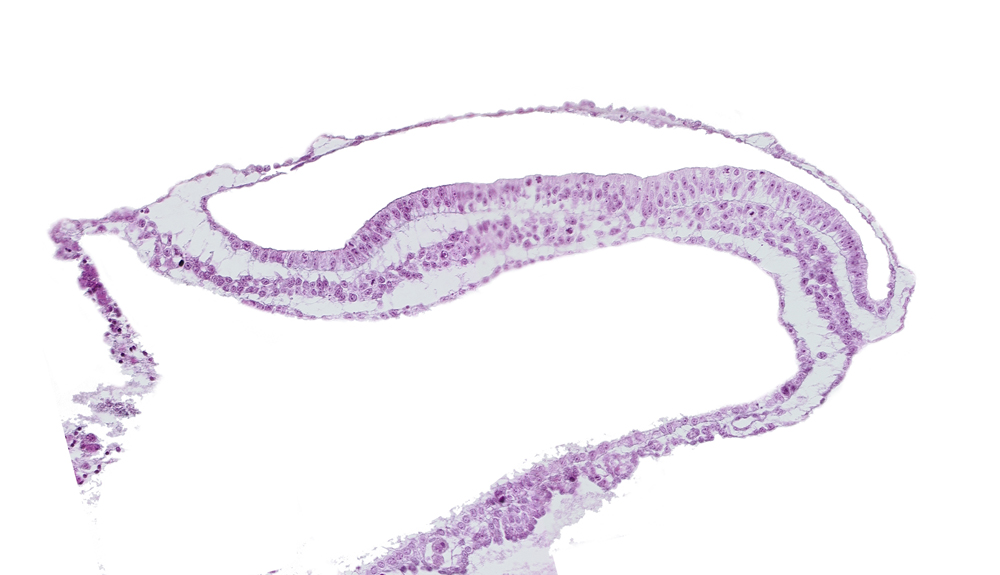 gastrulation (primitive) groove, gastrulation (primitive) streak, lateral plate mesoderm, paraxial mesoderm, umbilical vesicle hemangiogenesis