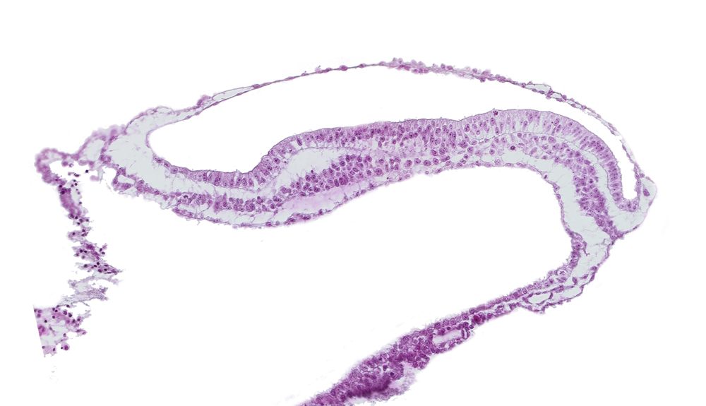 amniotic cavity, blood vessel in umbilical vesicle wall, endoderm, epiblast, gastrulation (primitive) groove, gastrulation (primitive) streak, mesoderm, transverse groove, umbilical vesicle cavity