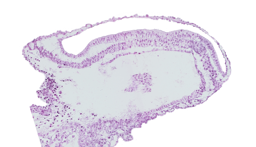 amniotic cavity, connecting stalk, edge of umbilical vesicle wall, gastrulation (primitive) groove, gastrulation (primitive) streak, lateral plate mesoderm, paraxial mesoderm, umbilical vesicle cavity