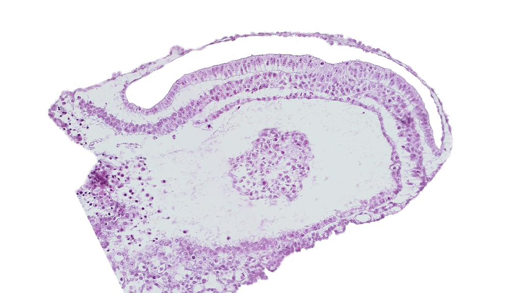 amniotic cavity, connecting stalk mesenchyme, extra-embryonic coelom, junction of embryonic and extra-embryonic mesoderm, umbilical vesicle cavity, umbilical vesicle wall cut tangentially