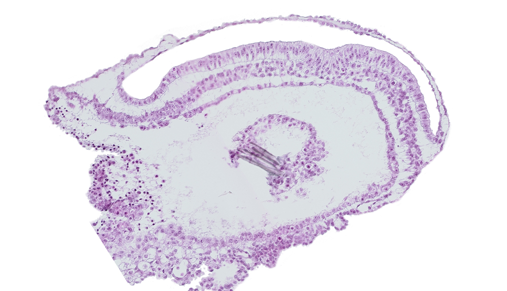 amniotic cavity, connecting stalk, extra-embryonic coelom, lateral plate mesoderm, umbilical vesicle cavity