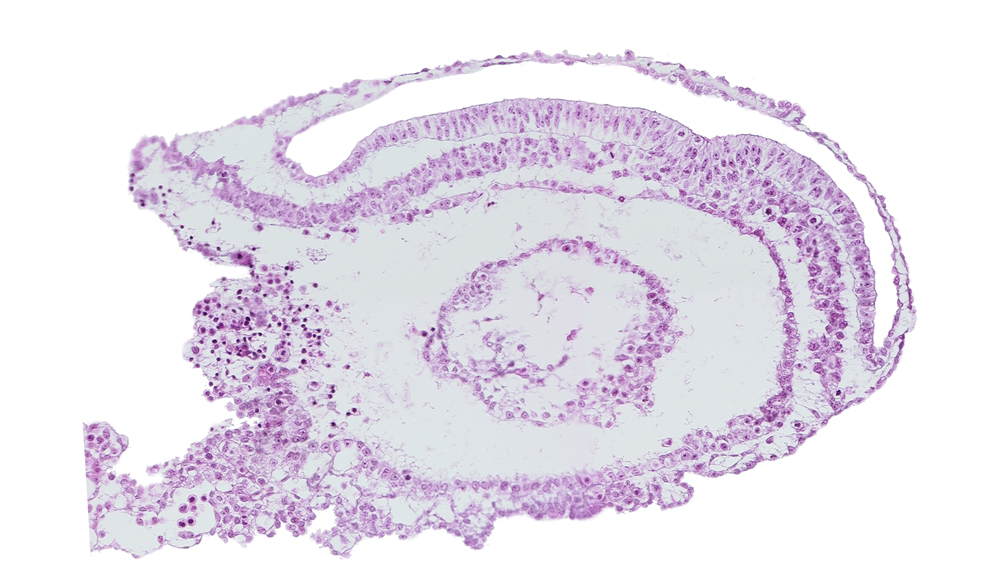 blood vessel(s), connecting stalk, embryonic endoderm, endometrial epithelium, extra-embryonic coelom, extra-embryonic endoderm, gastrulation (primitive) groove, gastrulation (primitive) streak, umbilical vesicle wall