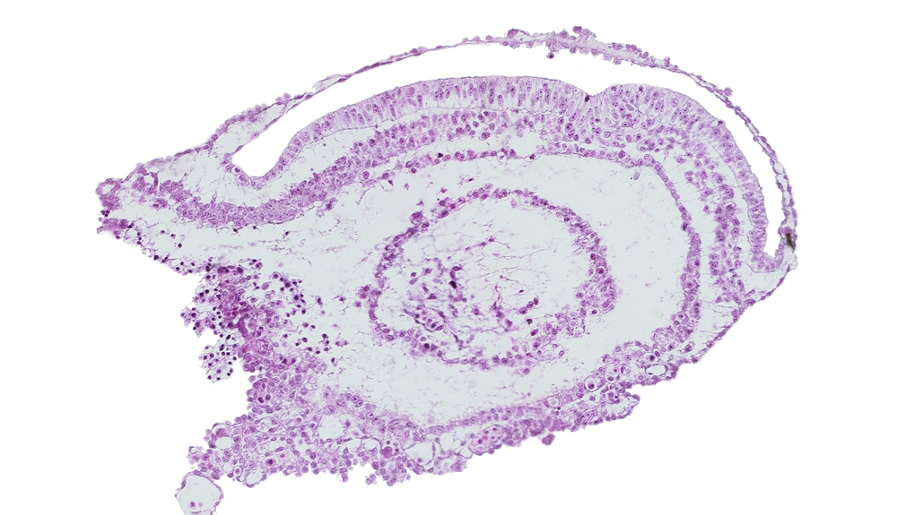 connecting stalk, endoderm, epiblast, gastrulation (primitive) groove, gastrulation (primitive) streak, mesoderm, umbilical vesicle cavity, umbilical vesicle wall